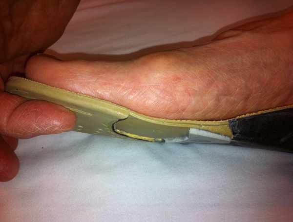 FootHealth 3 foot placed on orthotic device.